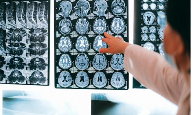 Ilustrasi/Foto: pexels.com